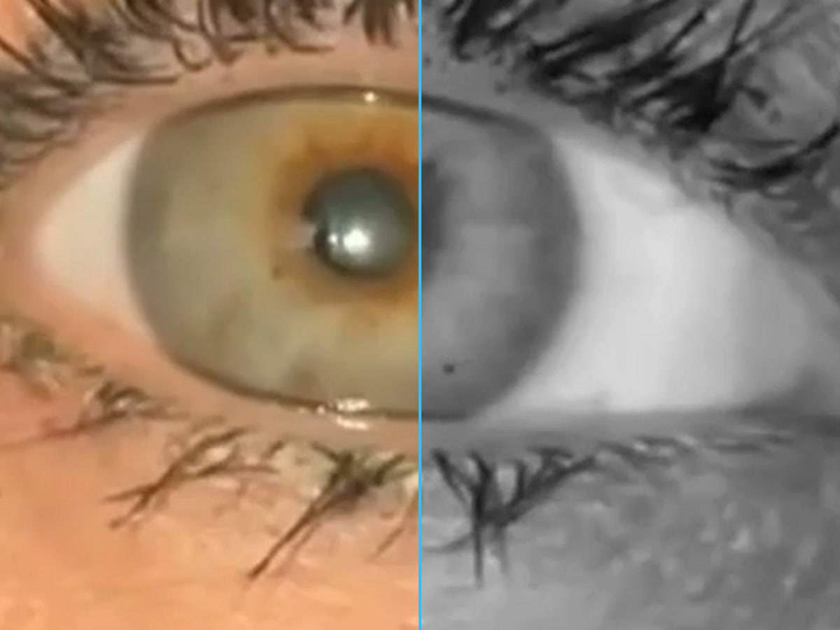 The same eye in full colour on the left and in infrared-style black and white on the right